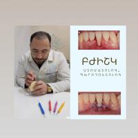 Tigran Harutyunyan Dentist periodontolog