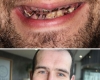 Shocking photos show what drinking six litres of fizzy pop every day did to man's teeth