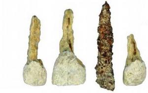 Ֆրանսիայում հայտնաբերվել է ատամի հնագույն իմպլանտ