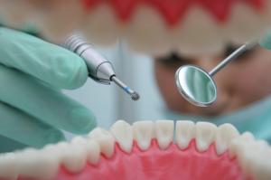 'No-drill' dentistry stops tooth decay, says research