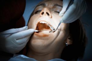 Have more than eight dental fillings? It could increase the mercury levels in your blood