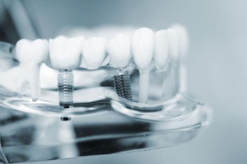 Սեփական ատամի վերականգնումը՝ ատամնաբուժության հեռանկարում