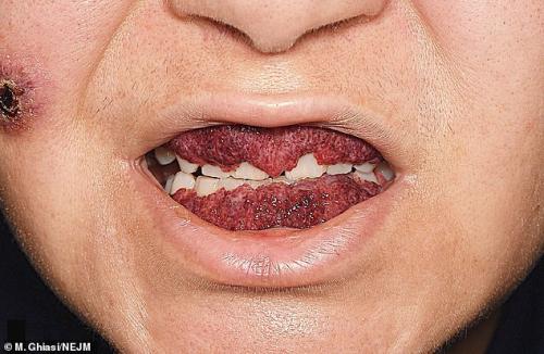 Doctors stunned by woman's rare disease that made her gums look like strawberries