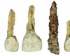 Ֆրանսիայում հայտնաբերվել է ատամի հնագույն իմպլանտ