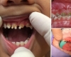 Shocking images reveal children as young as 18 MONTHS are having surgery for rotting teeth