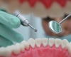 'No-drill' dentistry stops tooth decay, says research