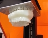 3D bioprinting to be used to replace missing teeth