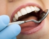 Создан новый пломбировачный материал, способствующий регенерации зуба