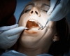 Have more than eight dental fillings? It could increase the mercury levels in your blood