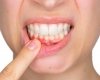 Periodontal disease increases cancer risk