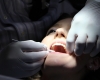 Մանկության բացասական ապրումները բարձրացնում են ատամները հասուն տարիքում կորցնելու ռիսկը
