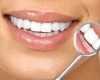 Մարգարտյա սպիտակությամբ ատամներ՝ առանց ատամնաբույժի այցելության